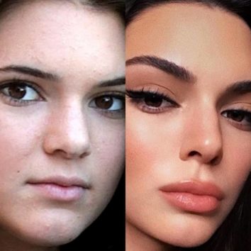 ケンダル・エンナーその若さで鼻筋も唇も…。