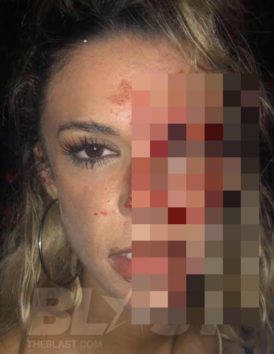 モデルや女優としてのキャリア構築が難しくなったナタリーさん