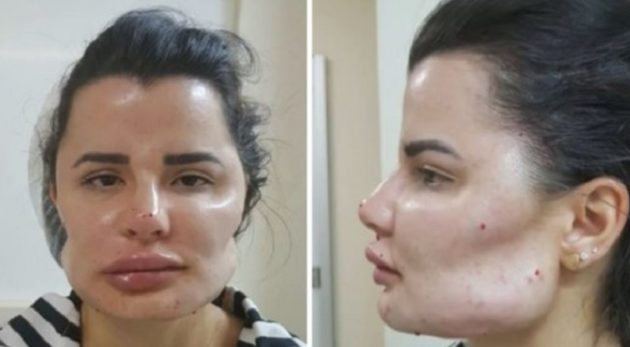 日系ブラジル人美容整形外科医を患者40名が訴える