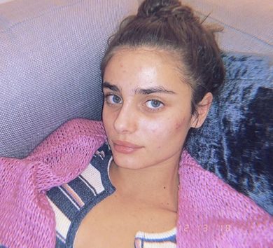ひどい肌荒れをインスタグラムでさらしたテイラー・ヒル