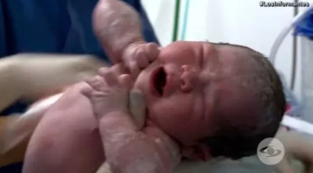 赤ちゃんの腹部には双子の弟の体が