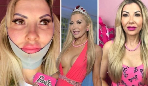 画像:『METRO』The UK’s oldest human Barbie has just had her 150th cosmetic surgery(Picture: Caters News)