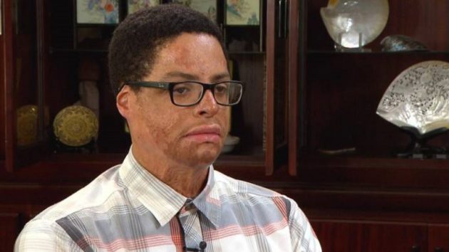 「まるで恐怖映画のよう…」と嘆く男性(Photo:Inside Edition)