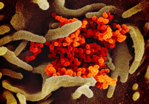 画像提供:National Institute of Allergy and Infectious Diseases