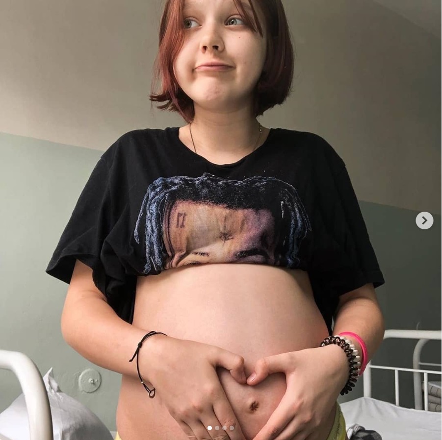 大きなお腹の13歳少女(画像はInstagramのスクリーンショット)